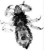 Head louse