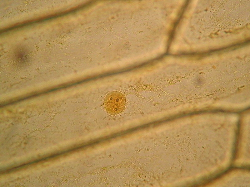 Iodine