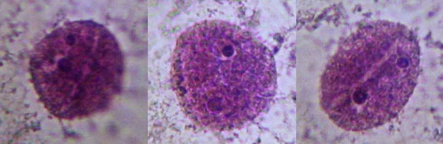 three nuclei