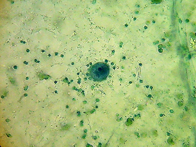 bladder nucleus 3