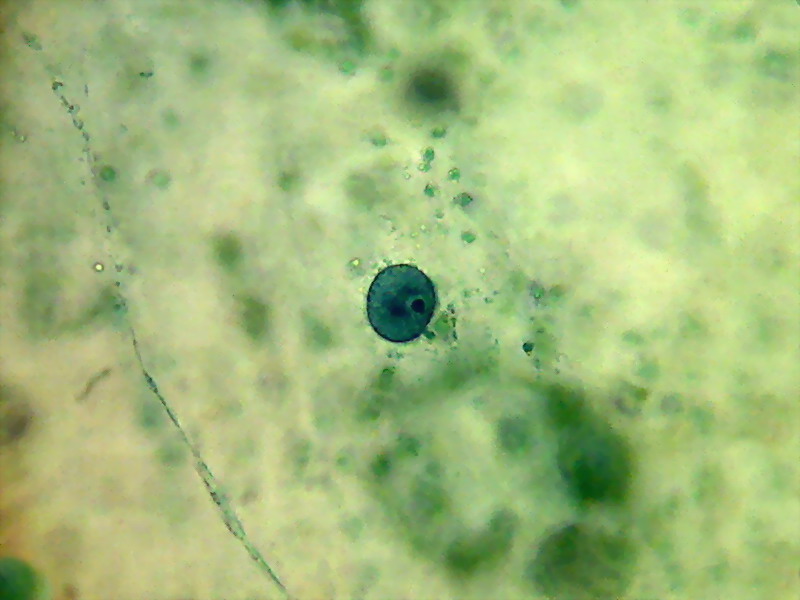 bladder nucleus 3
