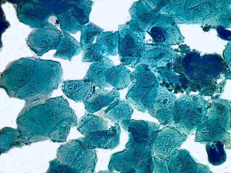 cheek cells 1