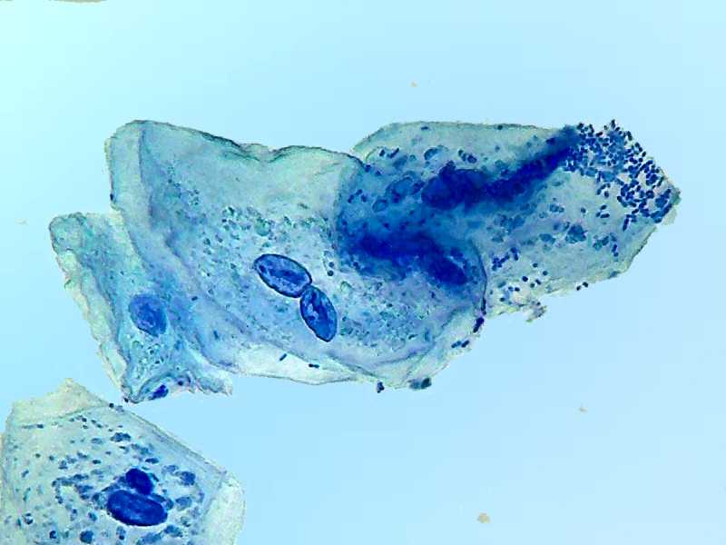 methylene blue 2